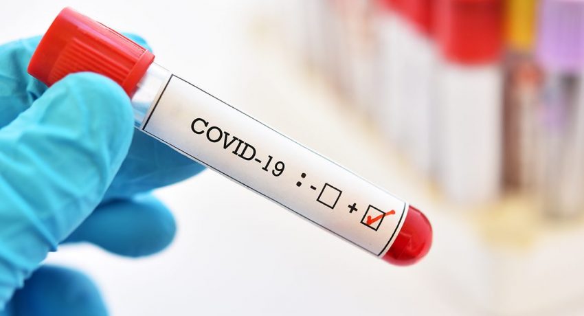 Ccoronavirus-test